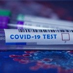 PUNKTOVI ZA TESTIRANJE NA PODRUČJU BBŽ